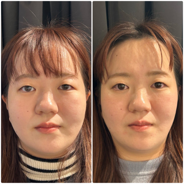 写真 2024-03-30 2025:2:26HPBブログ使用