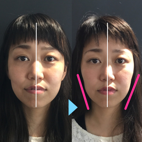 BeforeAfter写真